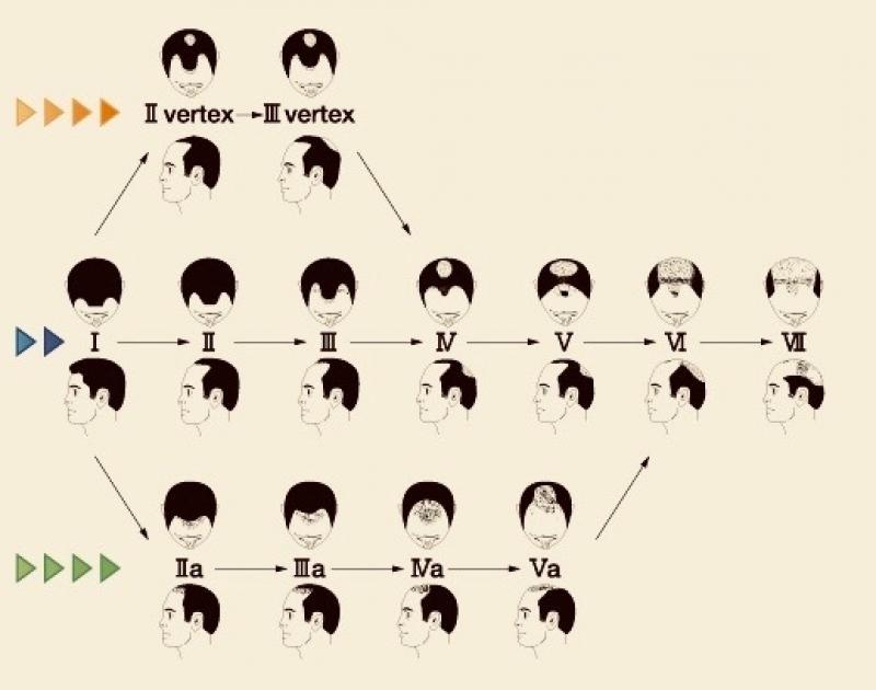 【大切なのは早めのケア！！】薄毛にならないために美容室でできるケア特集＆おすすめメンズスタイル6選